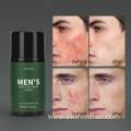 Moisturizing Anti Aging Men's Acne Treatment Cream